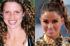 Katie Price before and after plastic surgery